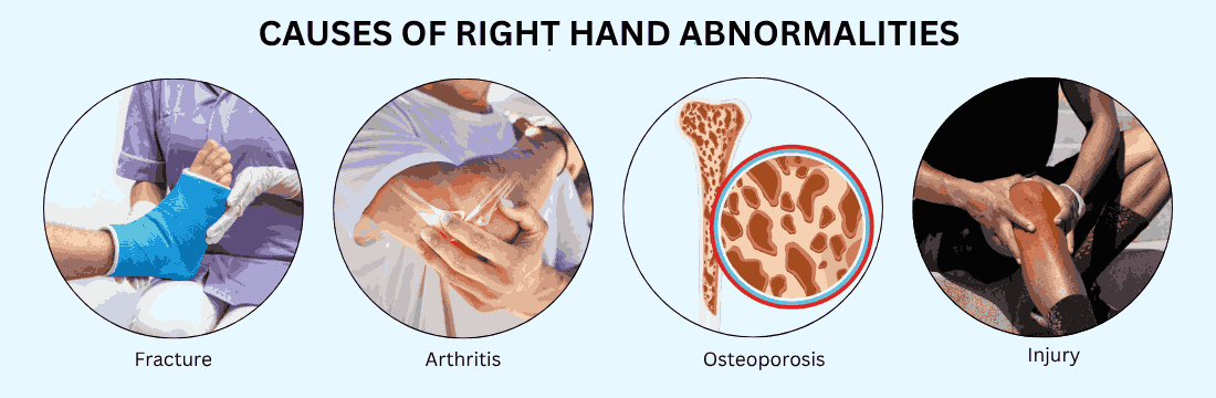 Causes of Right Hand Abnormalities